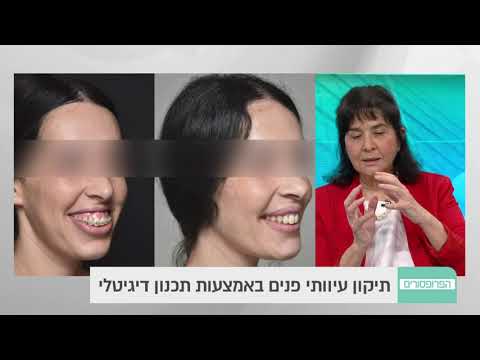 אורתוכירורגיה - ניתוחים לתיקון אסימטריה ועיוותים בפנים