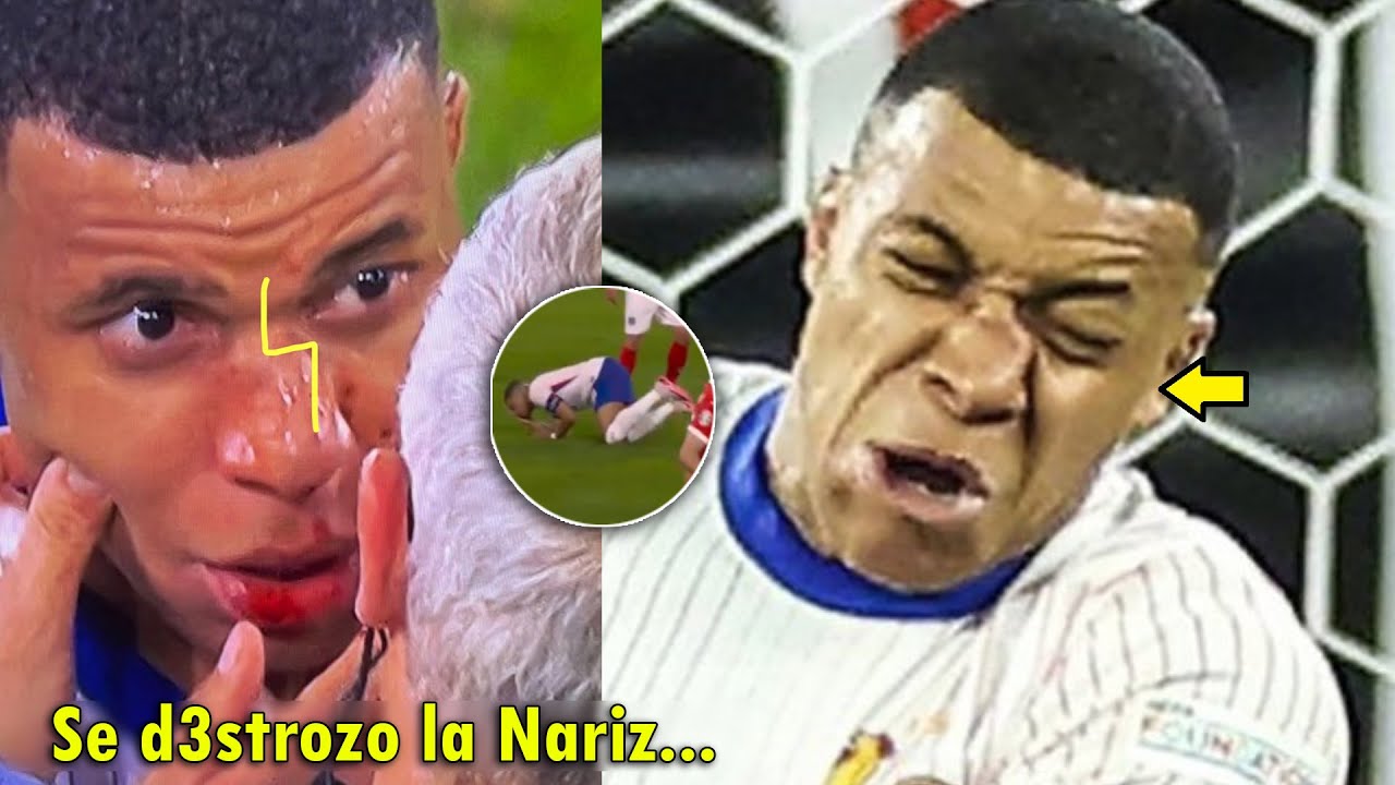 ASI FUE el TERRIBLE CHOQUE de MBAPPE SE ROMPIO! | FRANCIA VS AUSTRIA 1-0 HOY