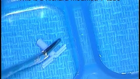 Tympanostomy with T-tube insertion