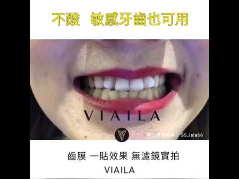 VIAILA速效超感白齿膜 敏感牙齒適用