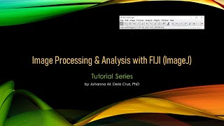 Are you a FIJI (ImageJ) beginner?