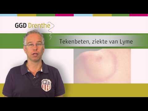 Video: Jeuken de uitslag van de ziekte van Lyme?
