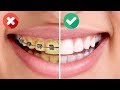 Download 25 ASTUCES BRILLANTES POUR AVOIR UN SOURIRE D’HOLLYWOOD 25 ASTUCES BRILLANTES POUR AVOIR UN SOURIRE D’HOLLYWOOD