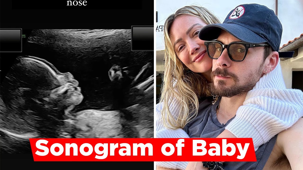 Pregnant Hilary Duff Shared Sonogram Of Baby YouTube