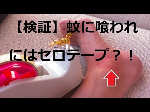 【 検証 】　蚊に喰われにはセロテープ？！　―　How to deal with the mosquito bites