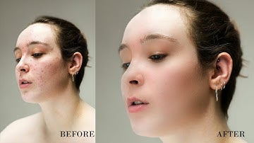 High-End Skin Retouching In-Depth Tutorial (Frequency Separation Step By Step In Photoshop)✔