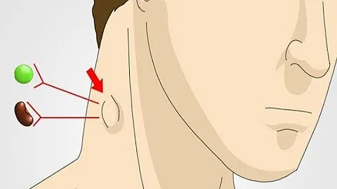Quando um Nodulo no pescoço e preocupante?