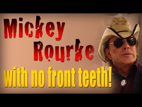 Mickey Rourke with no front teeth!