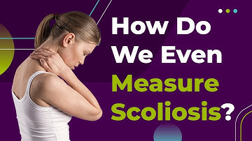 How Do We Even Measure Scoliosis?