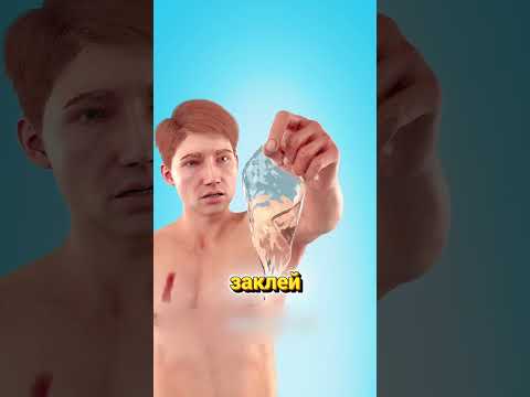 Почему дырка в лёгком — не повод паниковать, а повод срочно заклеиться @zackdfilms animator author