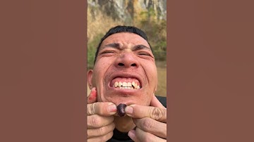 How I Cured a Bug Bite with Yogurt in theWild | Survival Hacks🎈