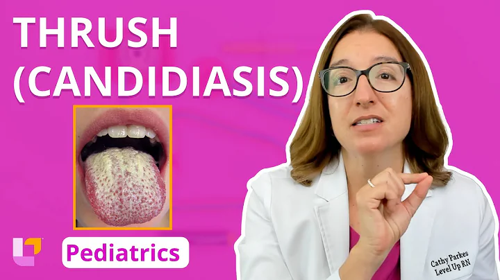 Thrush (Candidiasis): Integumentary System - Pediatric Nursing | @LevelUpRN