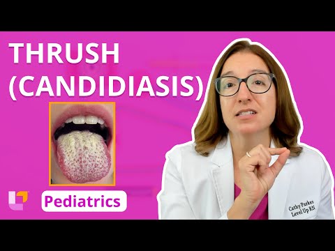 Thrush (Candidiasis): Integumentary