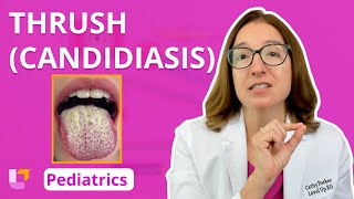 Thrush Candidiasis Integumentary System - Pediatric Nursing 