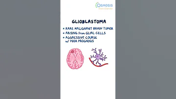 Glioblastoma 