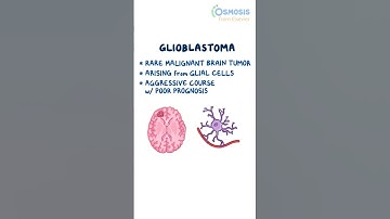 Glioblastoma