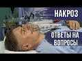 НАРКОЗ⛔️ ОТВЕТЫ НА ВОПРОСЫ