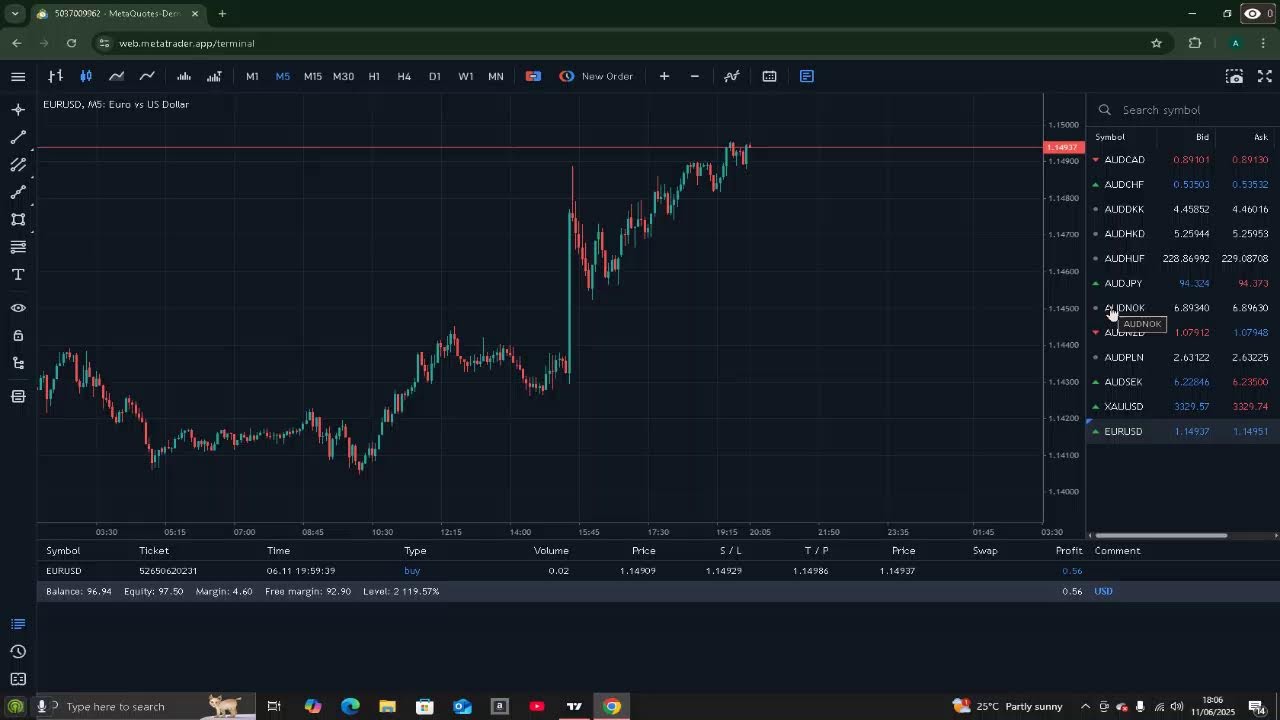 XAU/USD LONG? SHORT?