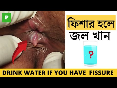 ভিডিও: পুলের জল চিকিত্সা: সরঞ্জাম, পদ্ধতি এবং সুপারিশগুলির একটি ওভারভিউ