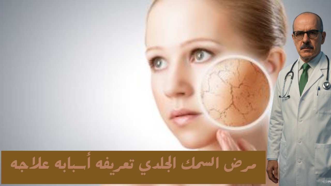 مرض السمك الجلدي تعريفه أسبابه علاجه         Hippocrates Medical Teaching & Consultation Academy