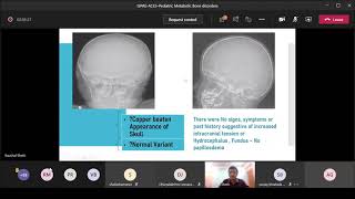 ISPAE-ACES case presentation: Dr. Kaushal V Sheth