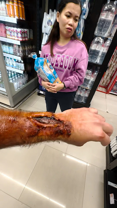 رسمت جرح عالايدي ومقلبت الناس