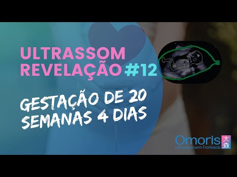 ULTRASSOM REVELAÇÃO #12 - Gestação de 20 semanas e 4 dias! Menino ou menina? Descobrindo juntos!