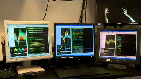 Large scale neural activity during bimanual movements