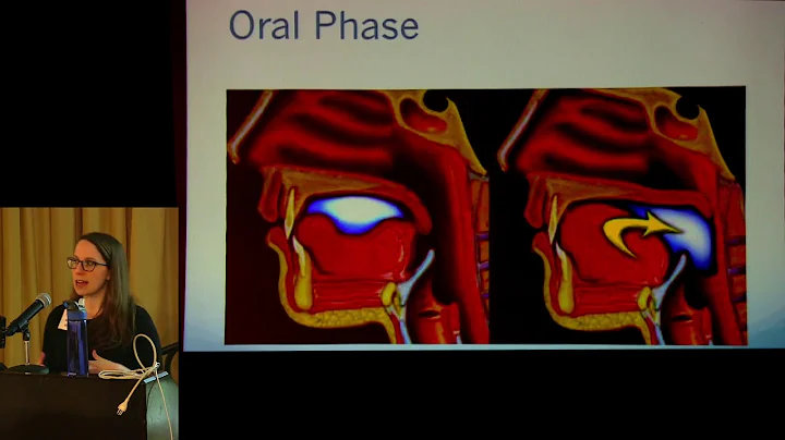 2019 NCSummit: Dysphagia & Speech Therapy - Michel...