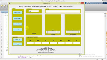 Matlab Code for Image Fusion on DICOM Images using  PCA