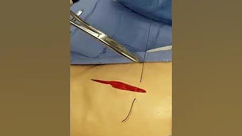 Clinical Lab Skills- Simple Interrupted Suture wit...