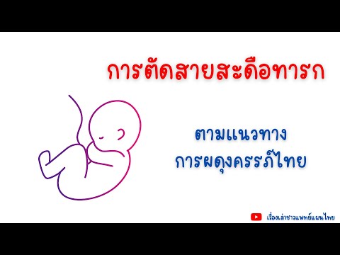 วีดีโอ: 4 วิธีในการตัดสายสะดือของทารก