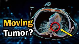 4D CT Scan Explained: Why "Time" Matters (Heart & Lung Imaging)