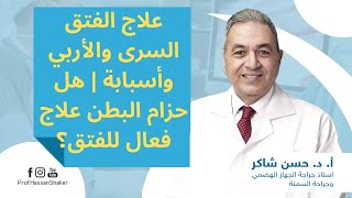 علاج الفتق السرى والأربي وأسبابة | هل حزام البطن علاج فعال للفتق؟