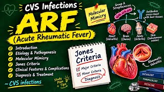 ARF (Acute Rheumatic Fever) | Molecular Mimicry & Jones Criteria | CVS Infections | Microbiology screenshot 5