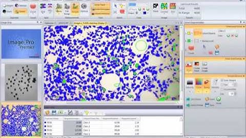 Automatically Count and Measure Objects Video   Image Pro Premier