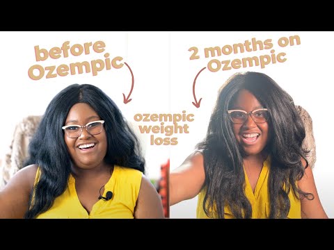 2 Months on Ozempic: weight loss before and after, side effects, injections from a patient&rsquo;s view
