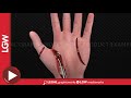 Left Hand Injury Animated Surgery Recreation