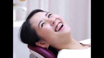 VÌ SAO KHÁCH HÀNG QUYẾT ĐỊNH NIỀNG RĂNG MẮC CÀI TẠI WESTWAY?