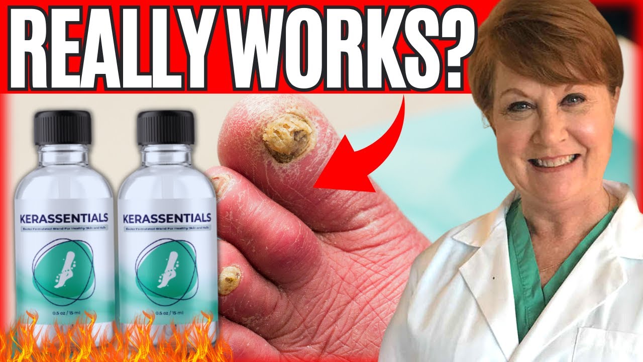Dr Kimberly Langdon Toenail Fungus Revfiews Dr Kimberly Langdon Toe Fungus – Dr Kimberly Fungus Treatment – Dr