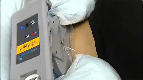 Dr. Mary Hurley discusses CoolSculpting