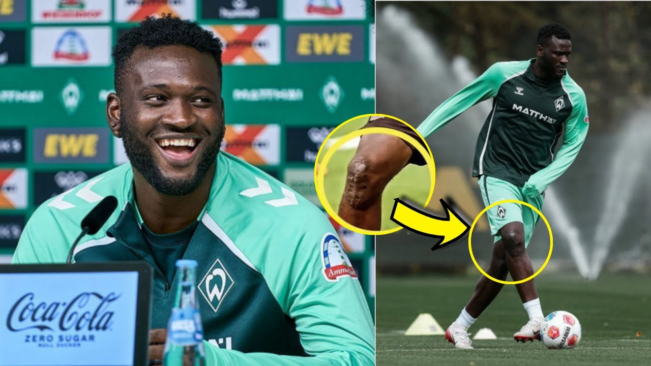 Victor Boniface on Fitness Concerns