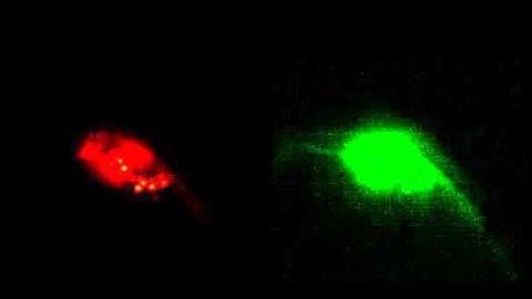 Raw video recording of whole brain imaging of a freely moving C.Elegans worm