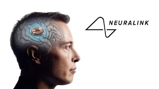 картинка: Neuralink хүн дээр туршилт хийжээ!