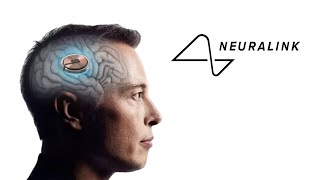 Neuralink хүн дээр туршилт хийжээ!