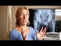 Hip Pain Treatment