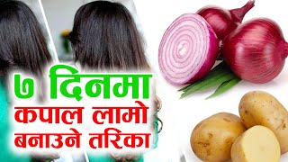 लामो कपाल पाउनुहोस मात्र एक हप्ता मा देखिनेछ फरक | Onion & Potat Treatment for Hair Growth In Nepali