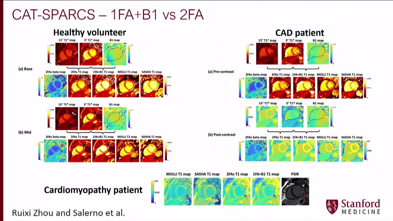 PlenarySession I 5 Trends in CMR  Highlights of SCMR 2022   Presented by Michael Salerno