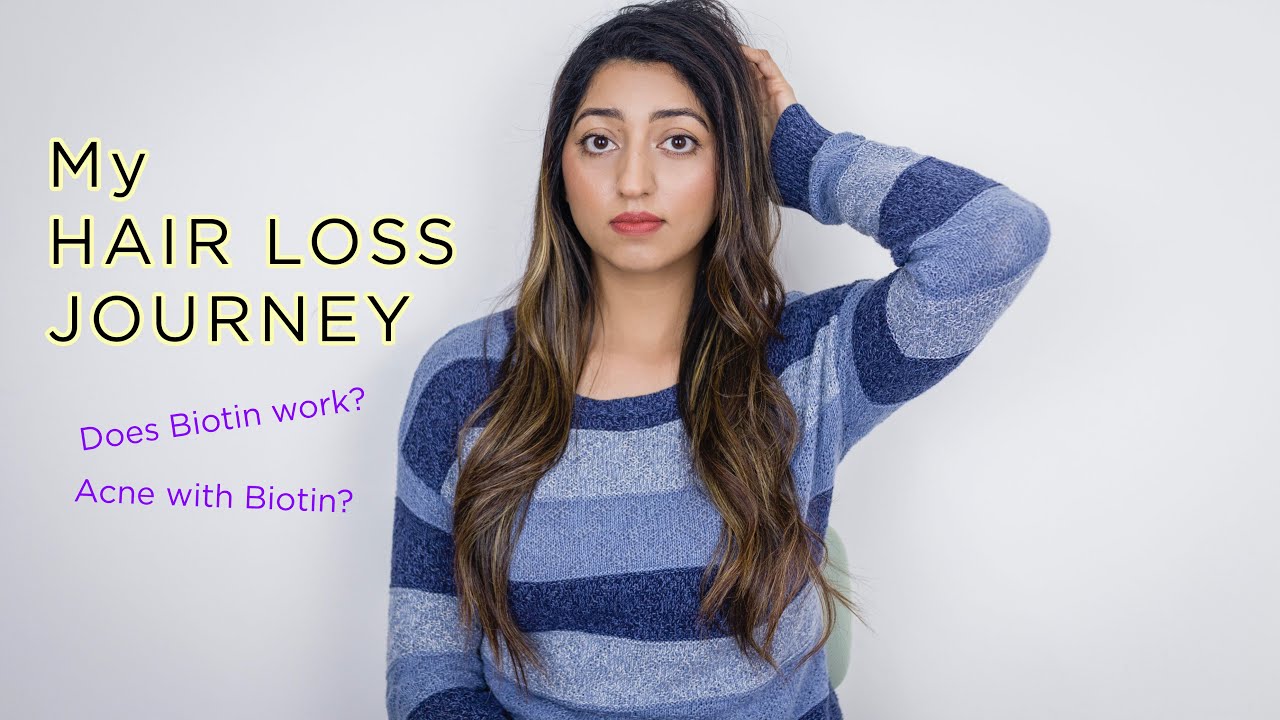 How I Stopped My Extreme Hair Fall YouTube