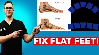 : How To FIX Flat Feet: 16 BEST Home Remedies [Shoes & Arch Insoles]